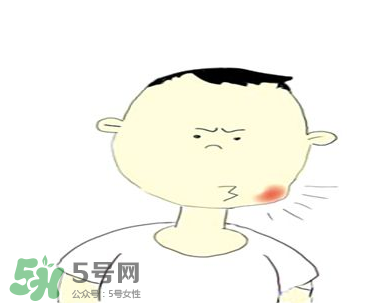 嘴角起泡是什么原因？嘴角起泡怎么辦？