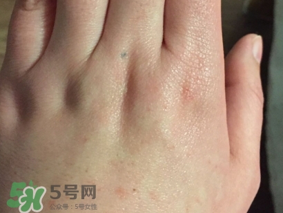 薇諾娜適合什么皮膚？薇諾娜適合敏感肌嗎？