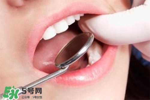 口腔異味是怎么回事？口腔異味怎么清除？