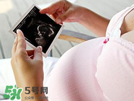 保胎期間可以洗澡嗎？臥床保胎可以洗澡嗎？