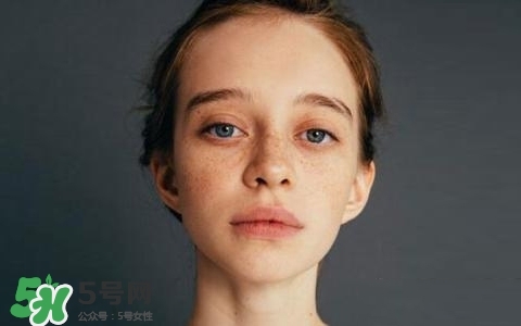 長(zhǎng)斑是什么原因引起的？祛斑效果最好的方法