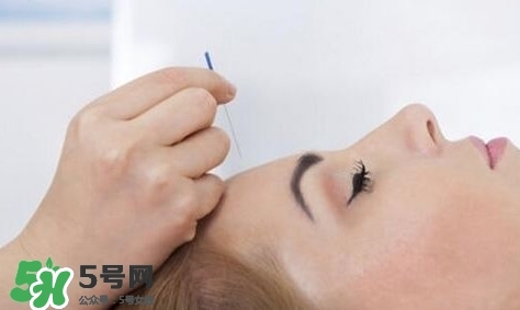 叢集性頭痛會(huì)死人嗎？叢集性頭痛的特點(diǎn)