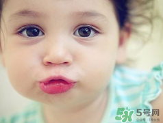 孕期可以激光祛斑嗎？懷孕了能做激光祛斑嗎？