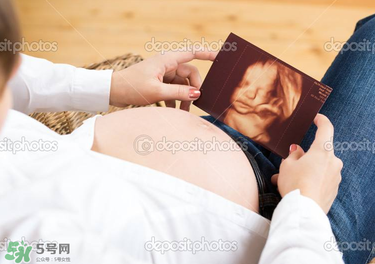 橄欖油真的可以預防妊娠紋嗎？橄欖油真的可以去妊娠紋嗎？