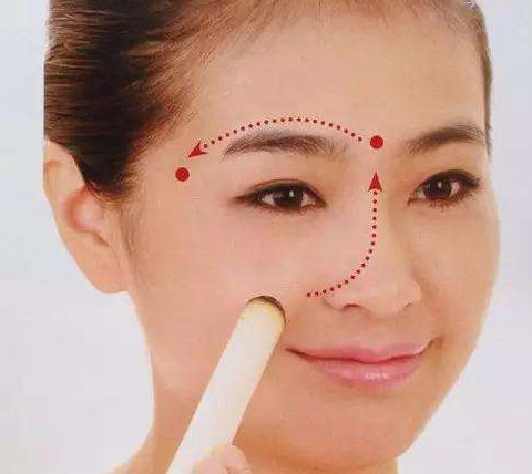 艾灸可以去黑眼圈嗎？艾灸可不可以去黑眼圈