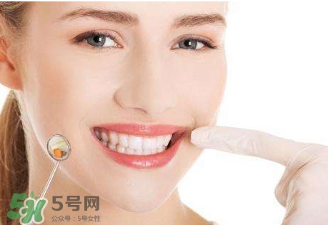 牙結(jié)石是什么？牙結(jié)石圖片