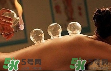 拔火罐疼嗎？拔火罐疼不疼