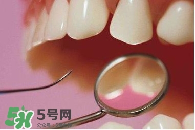 牙周炎傳染嗎？牙周炎會不會傳染