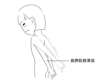 高低肩怎么糾正？高低肩的危害