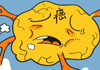 胃癌是怎么引起的？胃癌的早起癥狀