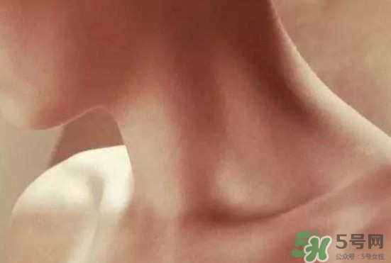 頸椎老化是什么?。款i椎老化的癥狀
