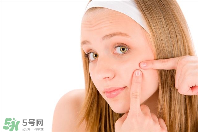 得了痤瘡飲食注意什么？有痤瘡吃東西注意什么
