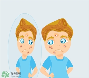 得了痤瘡飲食注意什么？有痤瘡吃東西注意什么