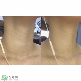 悅薇適合什么年齡？資生堂悅薇適合年齡段