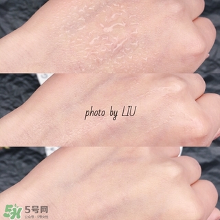 美帕b5噴霧有激素嗎？美帕噴霧副作用