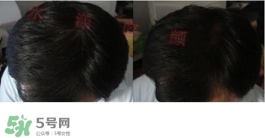  資生堂不老林洗發(fā)水怎么樣？資生堂不老林洗發(fā)水能長頭發(fā)嗎