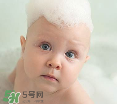 寶寶頭皮上的污垢可以摳掉嗎？寶寶頭上的頭垢該怎么處理？
