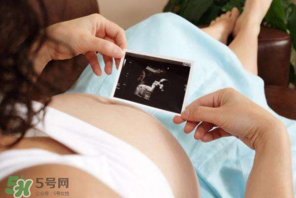 四維彩超能看出男女嗎？四維彩超能看清手指嗎？