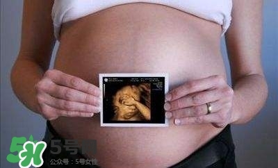 四維彩超能看出男女嗎？四維彩超能看清手指嗎？