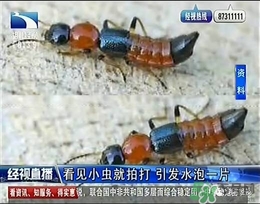隱翅蟲有毒嗎？隱翅蟲會(huì)毀容嗎？