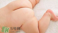 尿布疹怎么辦？寶寶尿布疹擦什么藥好？