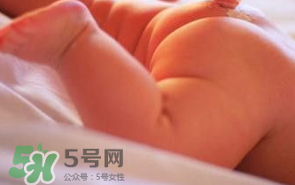 寶寶尿布疹可以擦紅霉素軟膏嗎？紅霉素軟膏對尿布疹有效嗎？