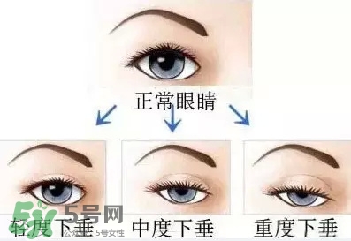 長期用假睫毛雙眼皮貼對眼睛有什么傷害？