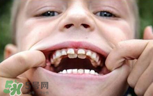 兒童換牙可以吃鈣片嗎?兒童換牙吃什么好？