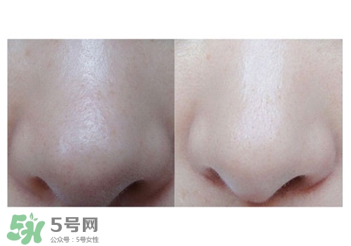 碧柔鼻貼白色和黑色哪個(gè)好？碧柔鼻貼黑白區(qū)別