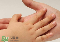 寶寶指甲凹凸不平是什么原因？寶寶指甲凹凸不平正常嗎？