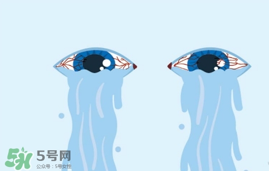 眼藥水可以?xún)蓚€(gè)人用嗎？眼藥水可以共用嗎？