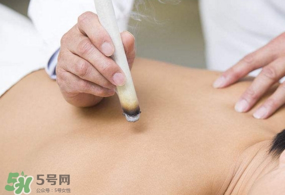 一天中什么時(shí)間艾灸好？艾灸什么時(shí)間做最好