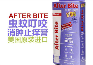 after bite止癢膏好用嗎？after bite止癢膏怎么樣？