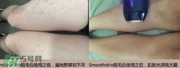 smoothskin和slikn infinity哪個好？smoothskin脫毛儀怎么樣