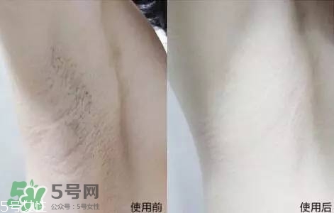 nair脫毛膏評(píng)測(cè)？nair脫毛膏保質(zhì)期