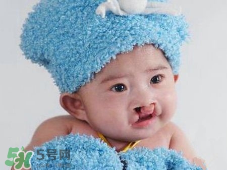 兔唇可以治嗎？兔唇修補術(shù)