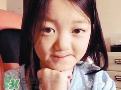 兔唇是什么？兔唇是什么原因造成的？