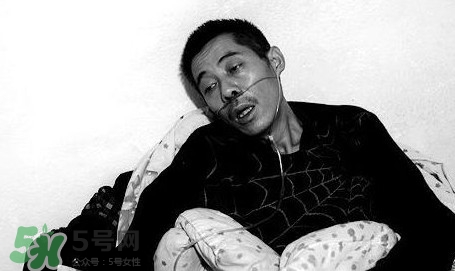 塵肺病吃什么藥能清肺？塵肺病國家有什么政策