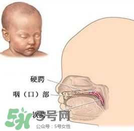 兔唇能檢查出來(lái)嗎？兔唇能完全修復(fù)嗎？