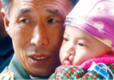 兔唇是什么？兔唇是什么原因造成的？