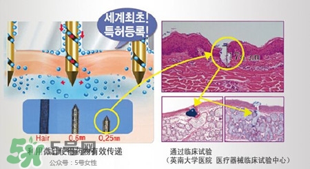 珠兒麗蚊子針好用嗎？珠兒麗蚊子針副作用
