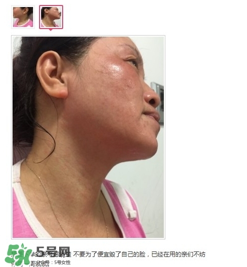 肌膚之食是什么牌子？肌膚之食讓我毀容了