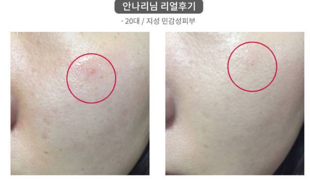 real skin patch怎么樣？real skin是什么牌子
