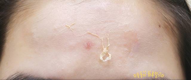 real skin patch怎么樣？real skin是什么牌子