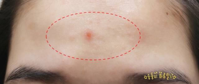 real skin patch怎么樣？real skin是什么牌子