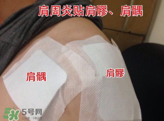 艾灸貼多少錢一盒?？艾灸貼一盒60裝多少錢？