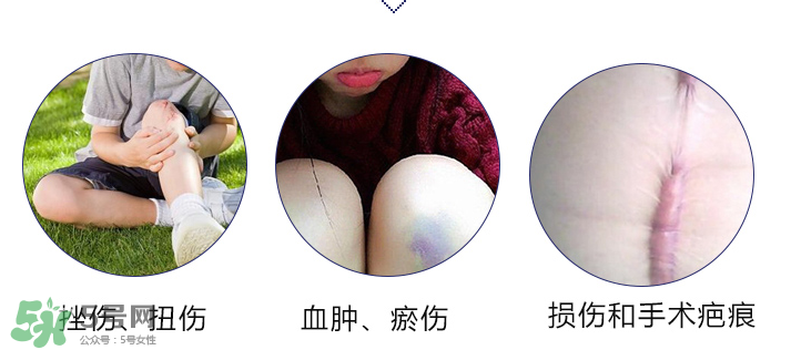 hirudoid除疤膏有效嗎？hirudoid去疤膏效果如何？