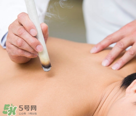 三伏貼和艾灸哪個(gè)好？三伏貼和艾灸區(qū)別