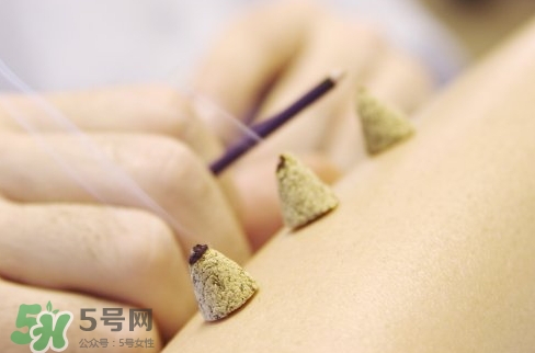 三伏貼和艾灸哪個(gè)好？三伏貼和艾灸區(qū)別