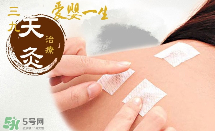 貼三伏貼可以吃魚嗎？貼三伏貼可以吃什么魚？